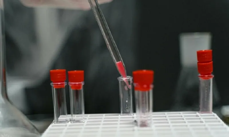 Australia làm thất lạc 300 lọ virus