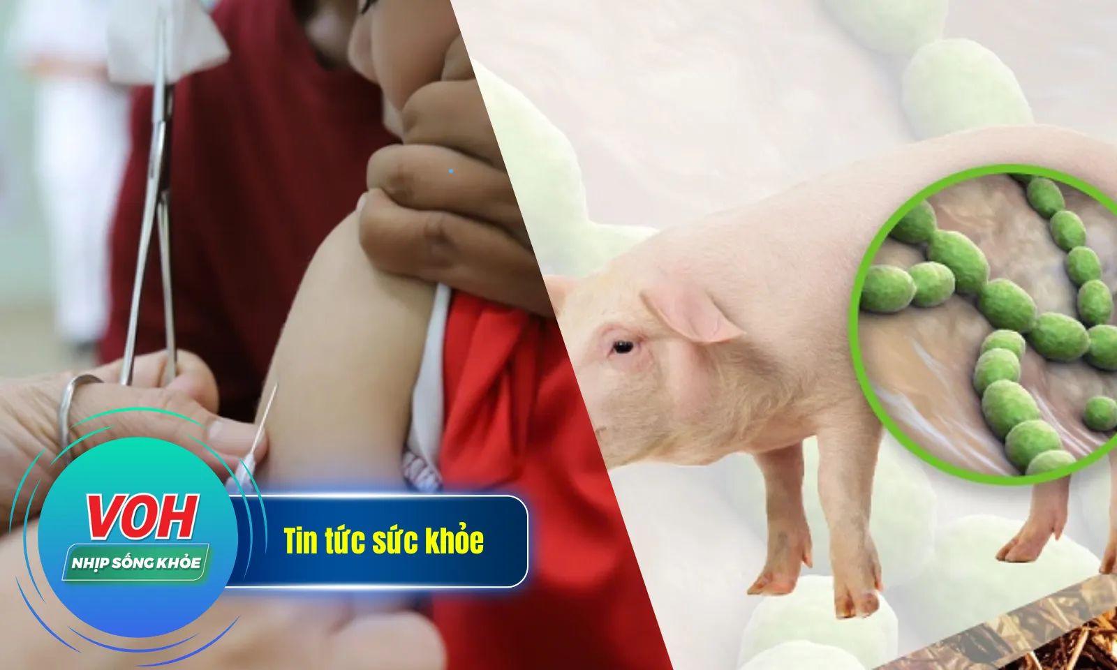 Nhịp Sống Khỏe 14/12 : Ca bệnh sởi TPHCM tiếp tục tăng | Phát hiện mắc liên cầu lợn sau khi bị sốt