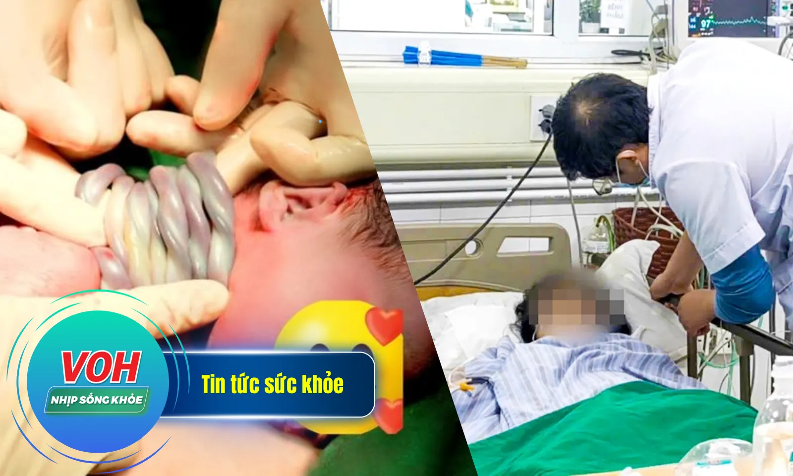 Nhịp Sống Khỏe 17/12: Rối loạn tâm thần do mắc u buồng trứng | Bé chào đời với 9 vòng dây rốn ở cổ