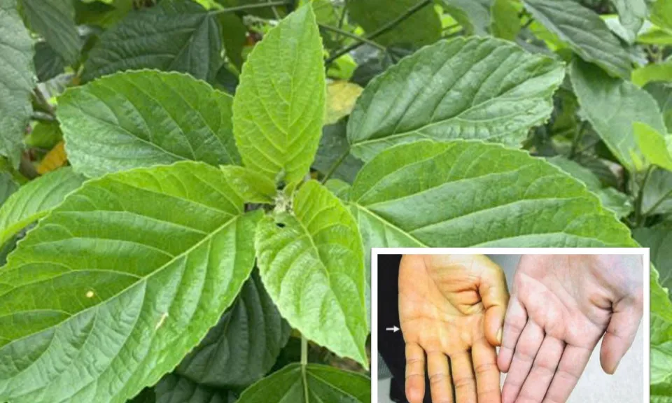Suy gan thận vì ăn lá lộc mại chữa táo bón