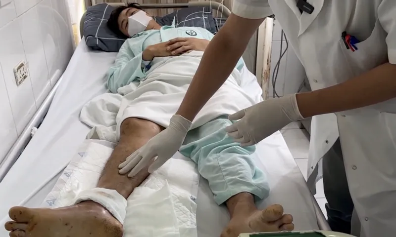 Hà Nội: Bệnh viện Hữu nghị Việt Đức​​​​​​​ nối thành công cổ chân đứt lìa do tai nạn lao động