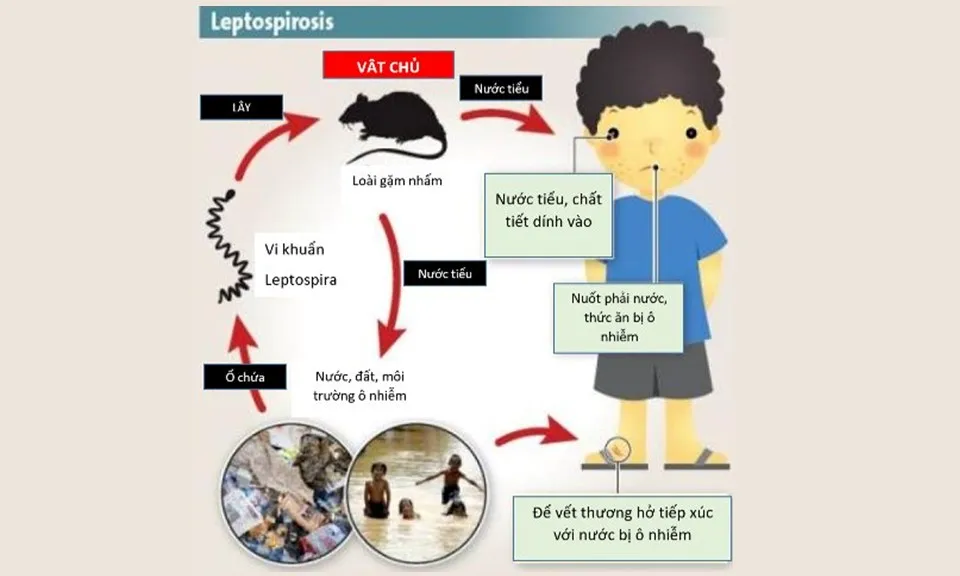 Cảnh báo trẻ em bị nhiễm xoắn khuẩn nặng do Leptospira từ chuột