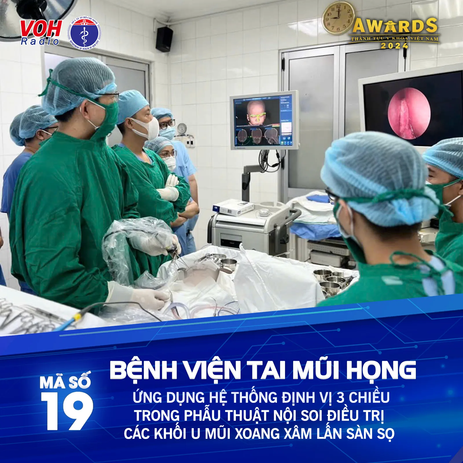 Đề cử 19 (BV Tai Mũi Họng) - Ứng dụng hệ thống định vị 3 chiều trong phẫu thuật nội soi điều trị các khối u mũi xoang xâm lấn sàn sọ