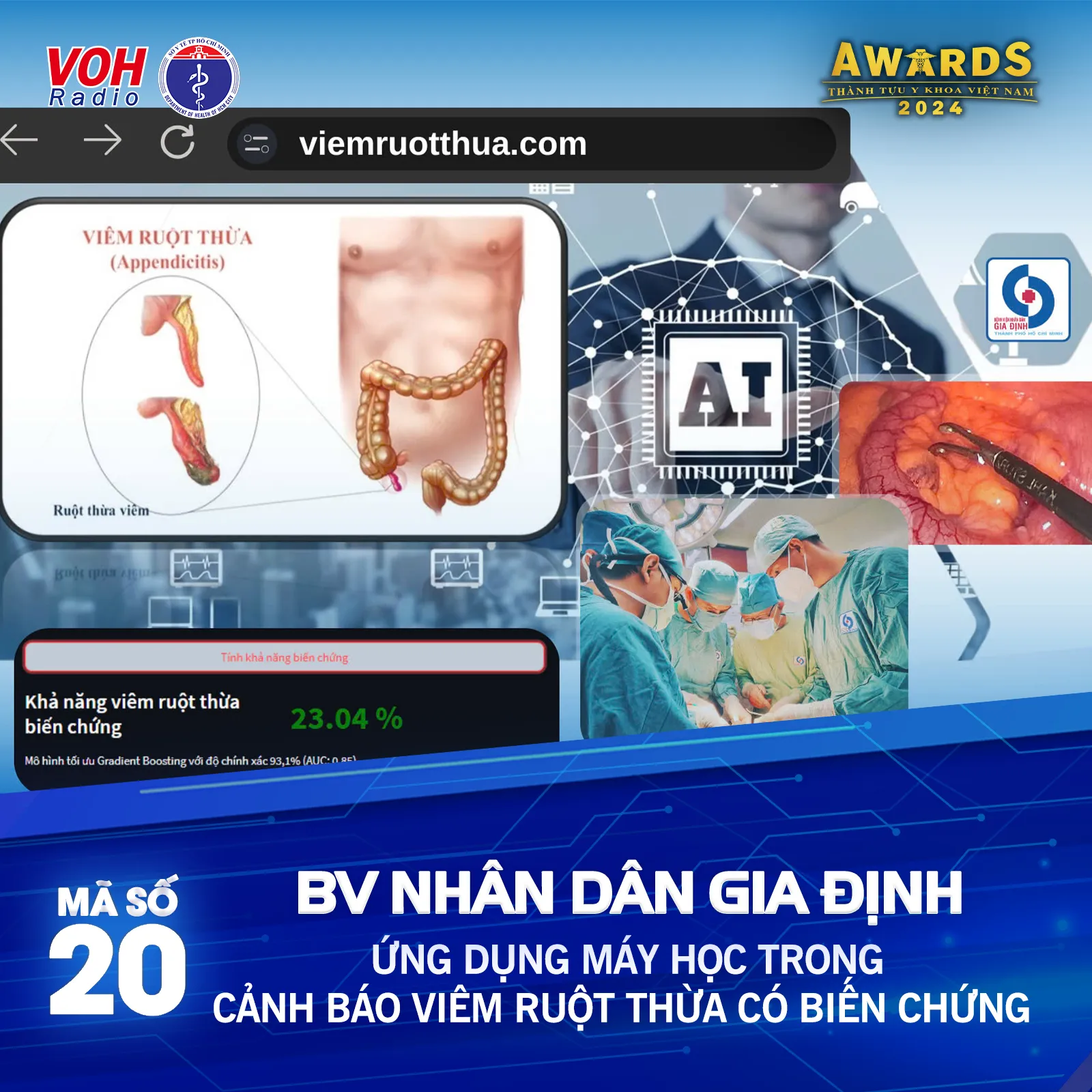 Đề cử 20 (BV Nhân Dân Gia Định) - Ứng dụng máy học trong cảnh báo viêm ruột thừa có biến chứng