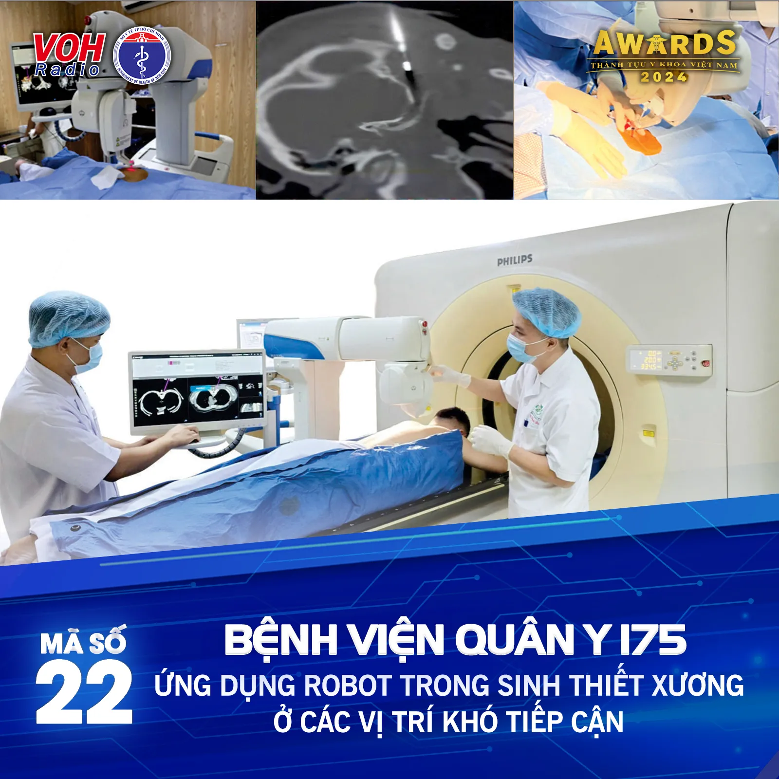 Đề cử 22 (BV Quân Y 175) - Ứng dụng robot trong sinh thiết xương ở các vị trí khó tiếp cận