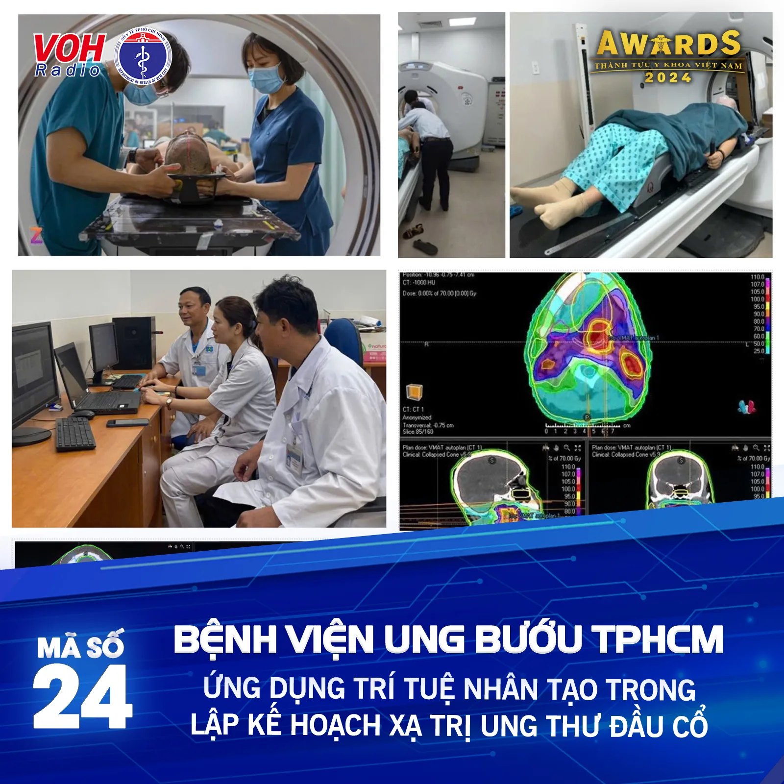 Đề cử 24 (BV Ung Bướu TP. Hồ Chí Minh) - Ứng dụng trí tuệ nhân tạo trong lập kế hoạch xạ trị ung thư đầu cổ