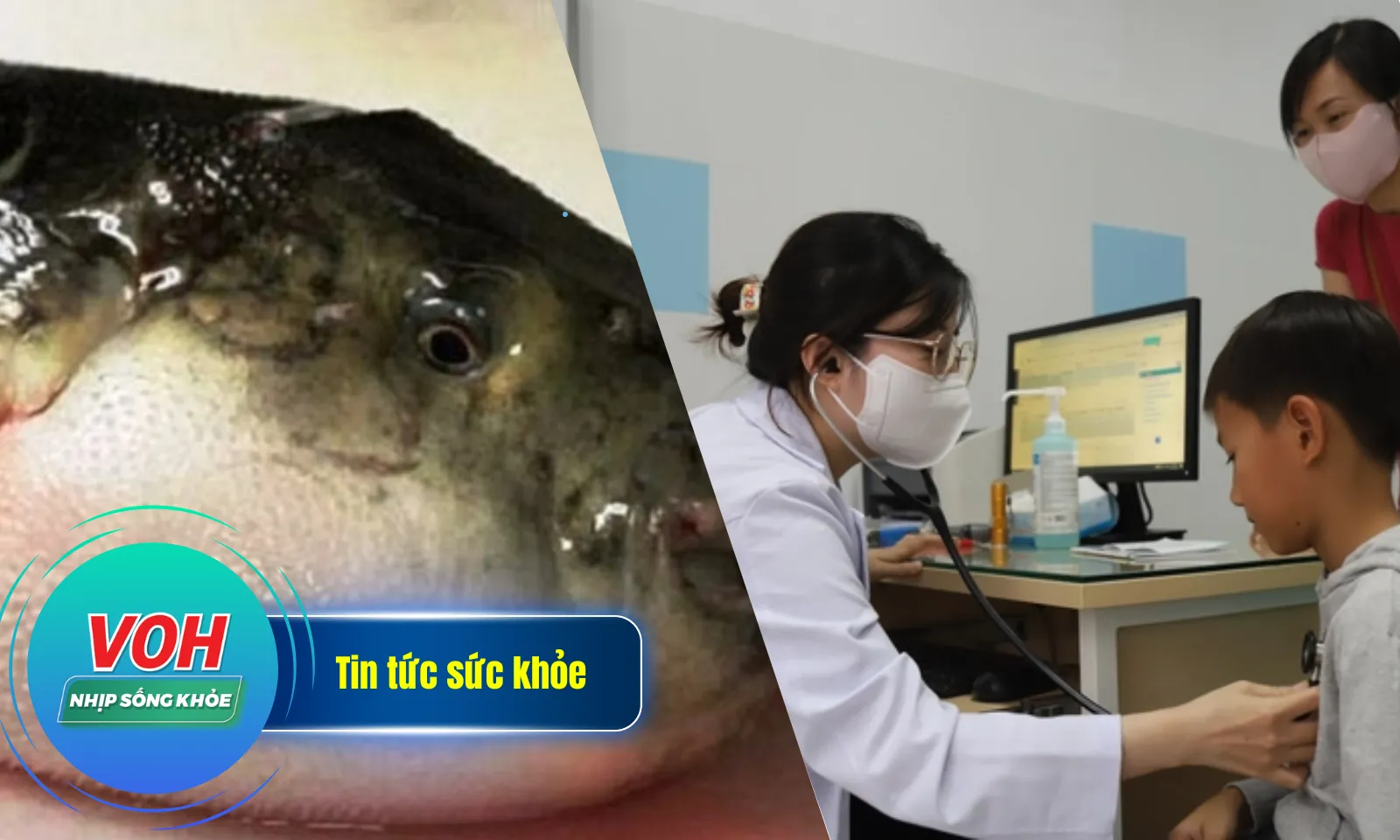Nhịp Sống Khỏe 8/1: Virus HMPV từng được phát hiện tại TPHCM | Ngộ độc cá nóc, 1 người đã tử vong
