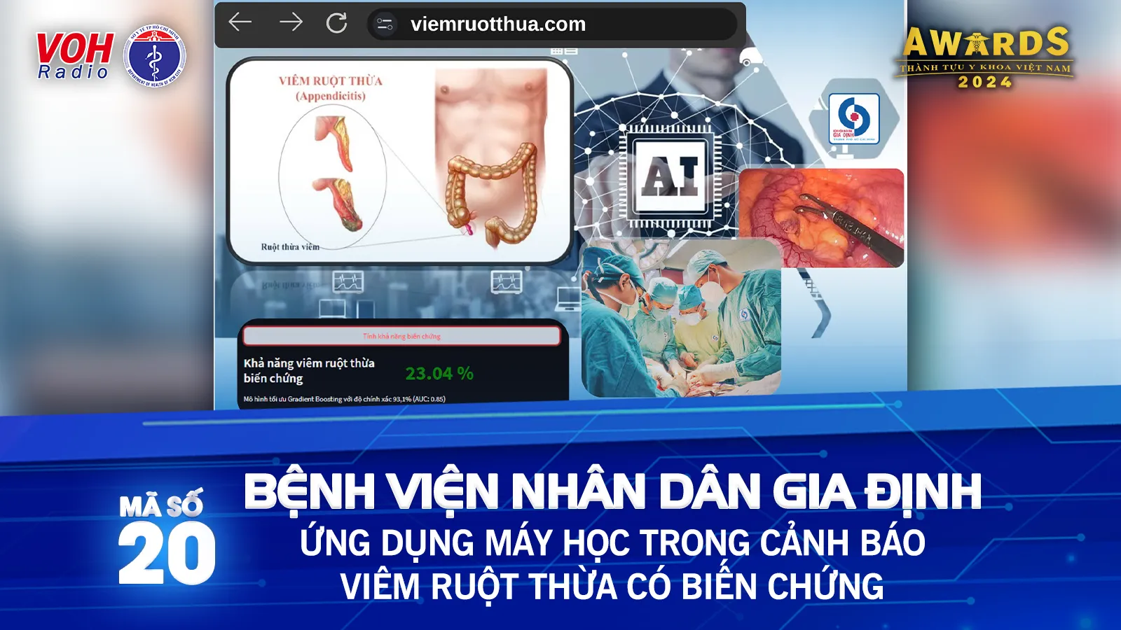 Đề cử 20: Ứng dụng máy học trong chẩn đoán viêm ruột thừa có biến chứng 