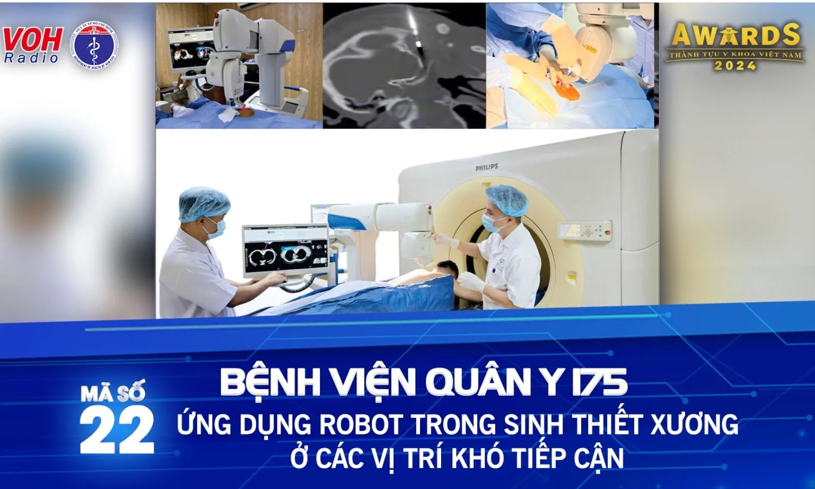 Đề cử 22: Ứng dụng robot trong sinh thiết xương ở các vị trí khó tiếp  cận