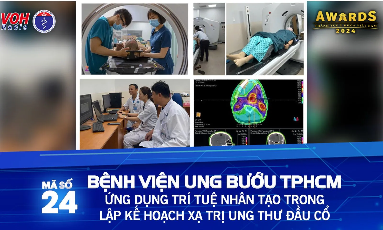 Đề cử 24: Ứng dụng trí tuệ nhân tạo trong lập kế hoạch xạ trị ung thư đầu cổ