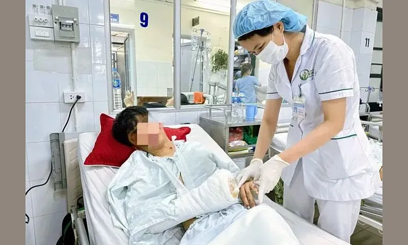 Hơn 200 ca cấp cứu do pháo nổ, pháo hoa trong ngày mùng 1 Tết