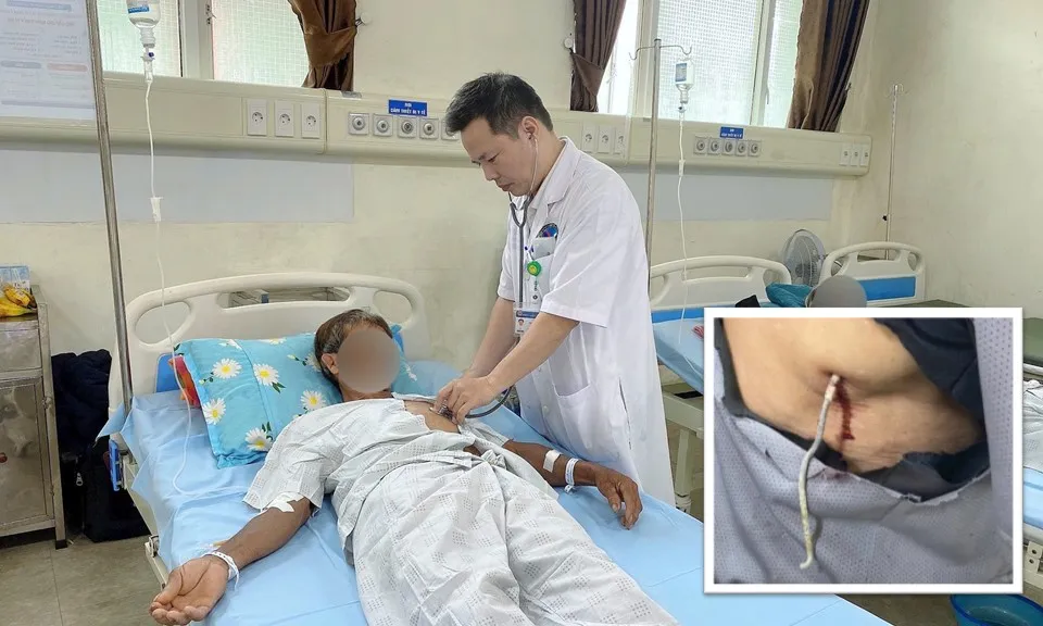 Cứu người đàn ông bị dây kẽm hàng rào đâm sâu vào ngực 10cm