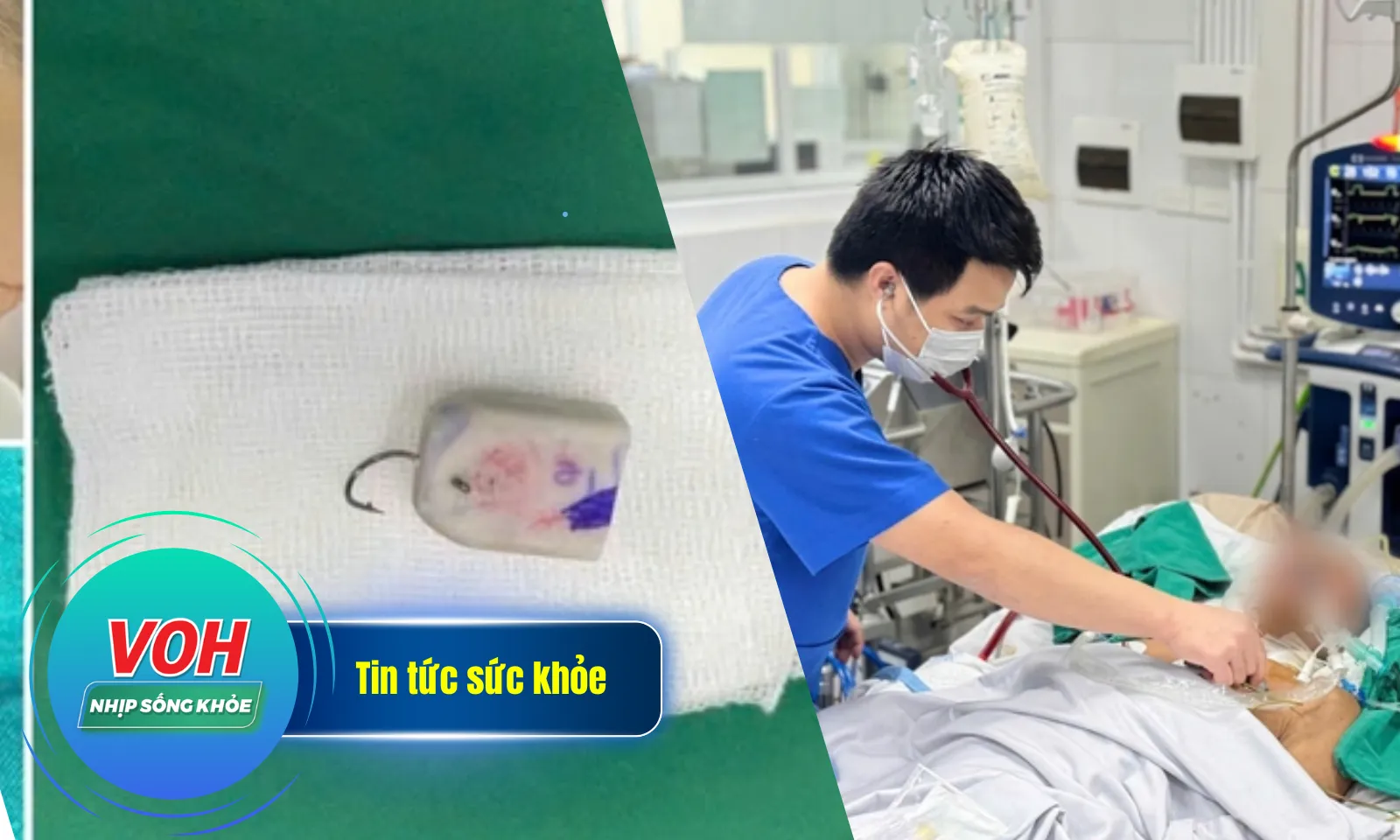 Nhịp Sống Khỏe 6/2: Bé trai 8 tuổi bị móc câu móc vào mi mắt | Can thiệp ECMO do suy hô hấp nặng