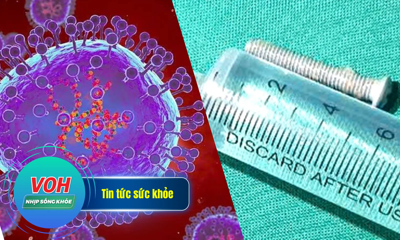 Nhịp Sống Khỏe 7/2: Gắp đinh vít dài 5cm khỏi dạ dày bé trai | Cúm mùa gia tăng ở nhiều quốc gia