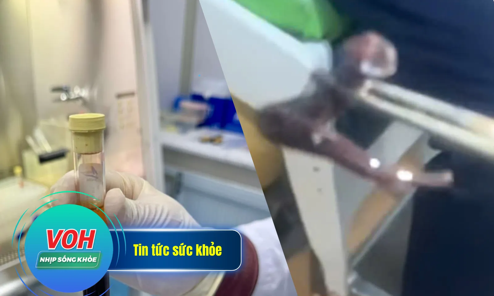 Nhịp Sống Khỏe 15/2: Đỉa rừng 7cm chui vào hốc mũi | Dùng máu của bệnh nhân làm keo dán sinh học