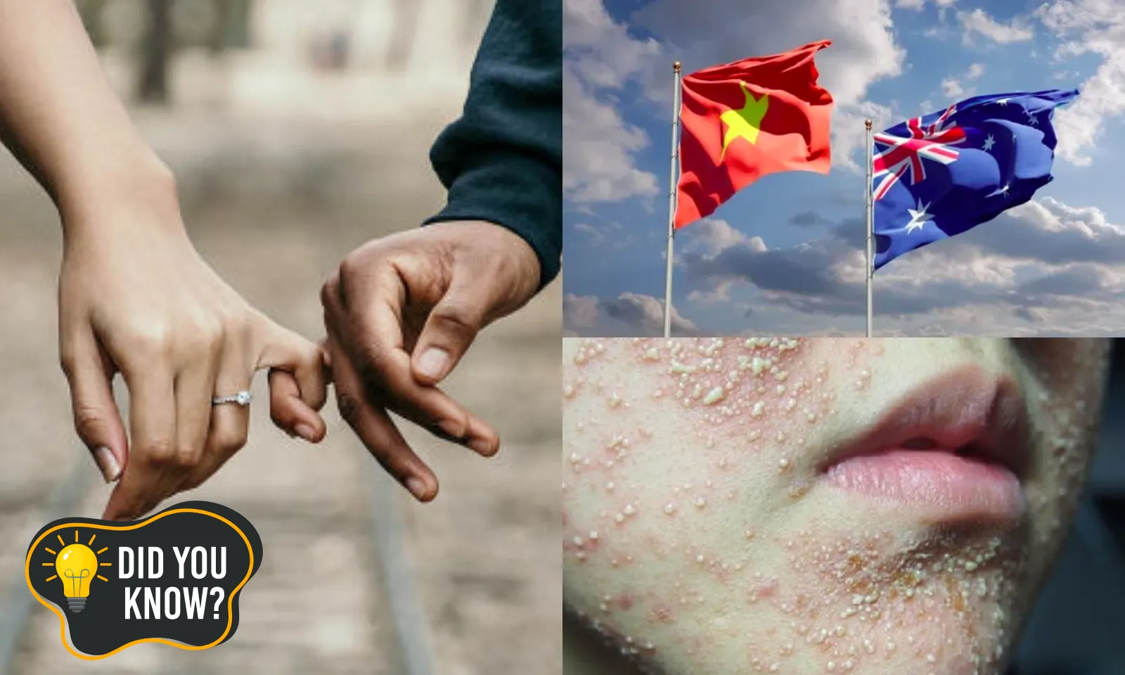 Bạn có biết 26/2: Vì sao TPHCM “chia tay” nhiều nhất? | Tiền mất, tật mang với “thần dược” trắng da