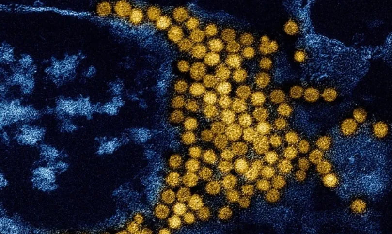 AI lần theo dấu vết ngàn tỷ virus bí ẩn trong cơ thể người 