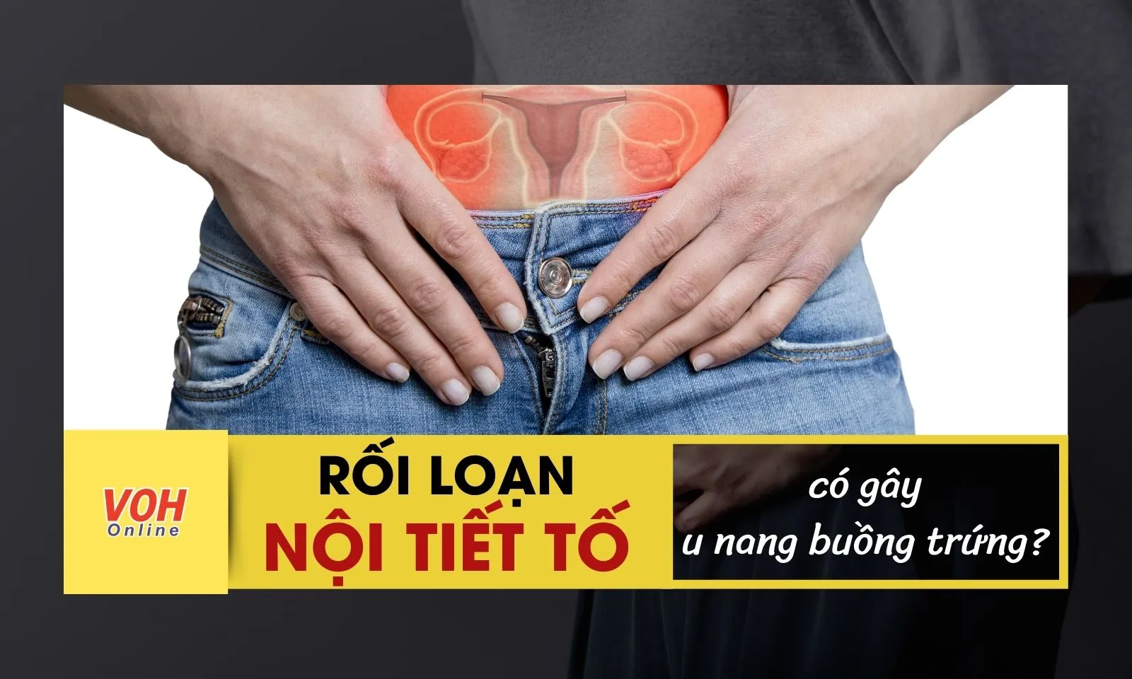 Rối loạn nội tiết tố nữ có gây u nang buồng trứng?