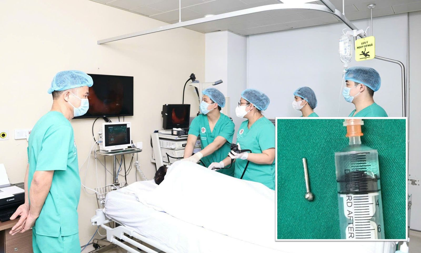 Thiếu nữ nhập viện cấp cứu vì lỡ nuốt khuyên đeo lưỡi khi ăn