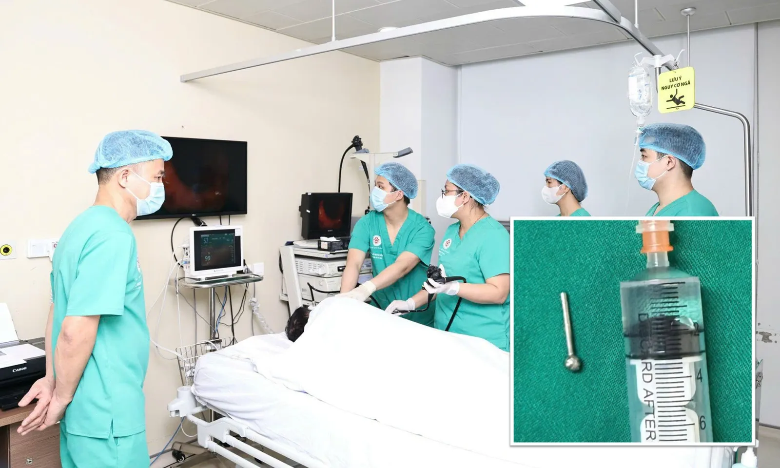 Thiếu nữ nhập viện cấp cứu vì lỡ nuốt khuyên đeo lưỡi khi ăn