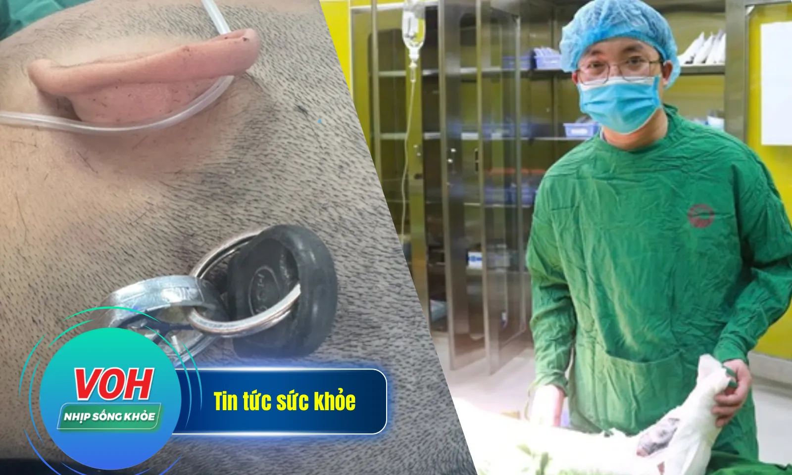Nhịp Sống Khỏe 13/3: Nam sinh bị chìa khóa cắm sâu vào đầu | Nhiễm trùng do đắp lá chữa vết thương