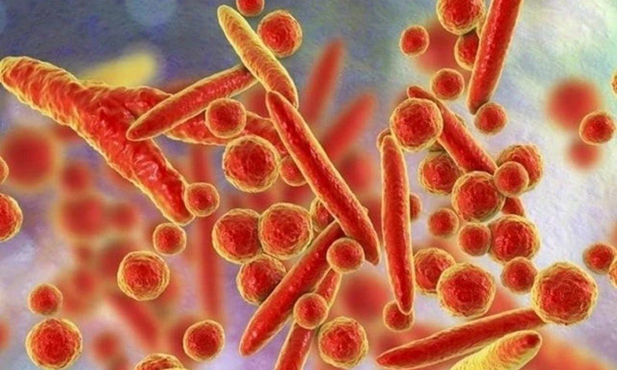 WHO bác bỏ thông tin về virus lạ gây ho ra máu ở Nga, xác nhận nhiễm vi khuẩn MP