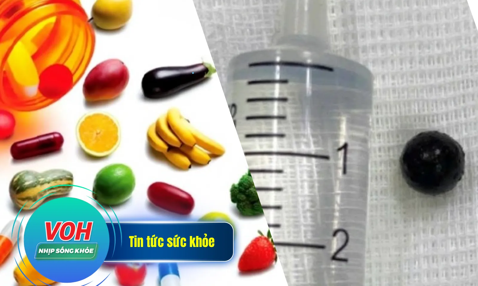 Nhịp sống khỏe 8/4: Suy kiệt vì TPCN và thực dưỡng | Đạn chì nằm trong hốc mũi 5 năm