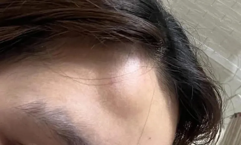 Nữ sinh bị đồng nghiệp đánh nhập viện vì tiền tip