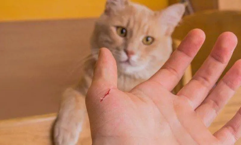 Mèo cắn nhưng chủ quan không xử lý, người đàn ông tử vong sau đó
