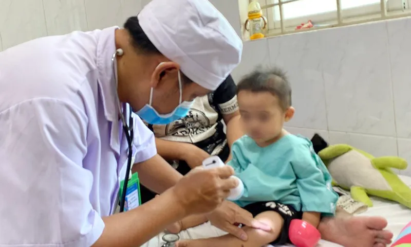 Gia tăng ca bệnh tay chân miệng tại Đồng Nai: Cảnh báo và khuyến cáo phòng bệnh