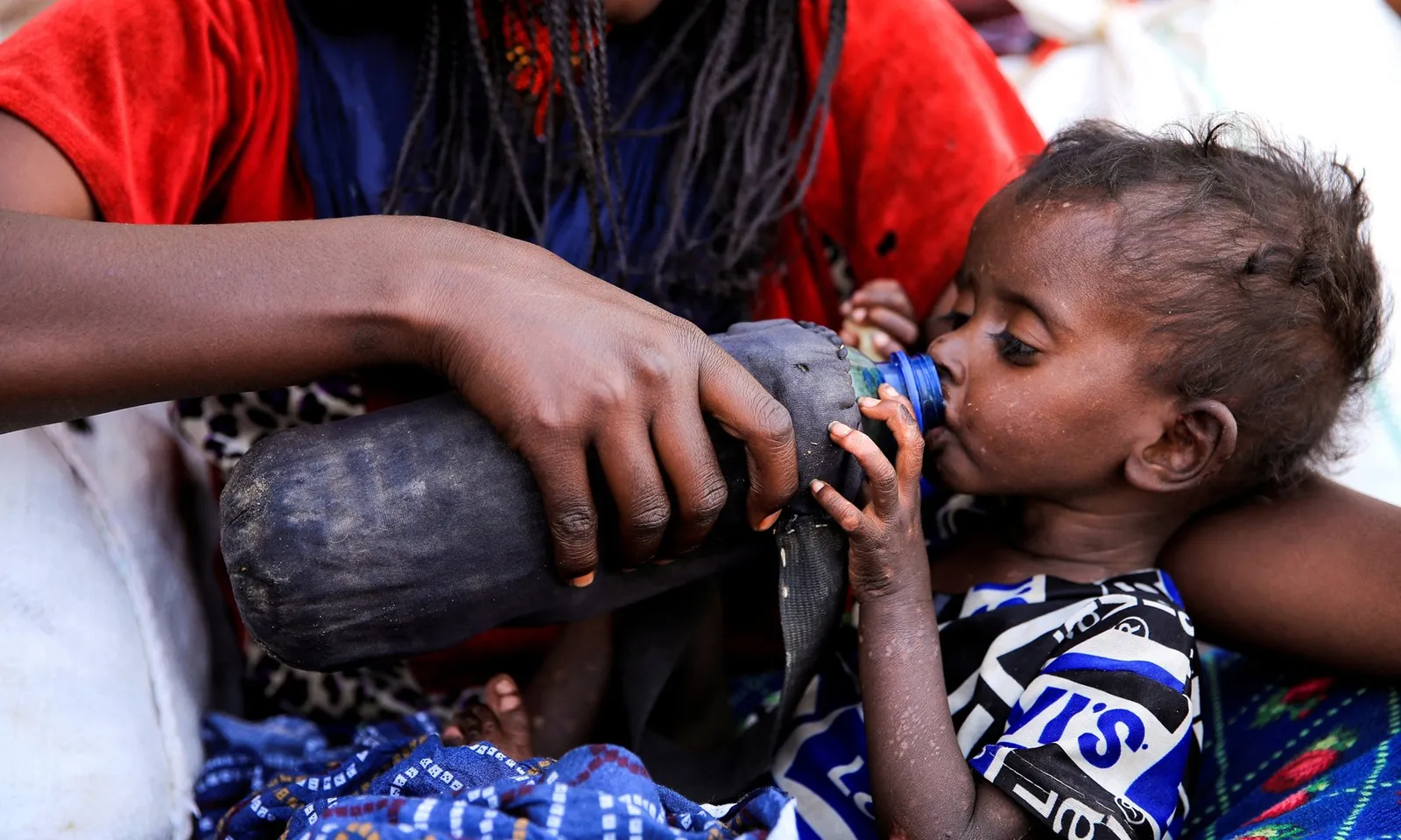 WFP tạm ngưng chương trình điều trị suy dinh dưỡng tại Ethiopia do thiếu ngân sách