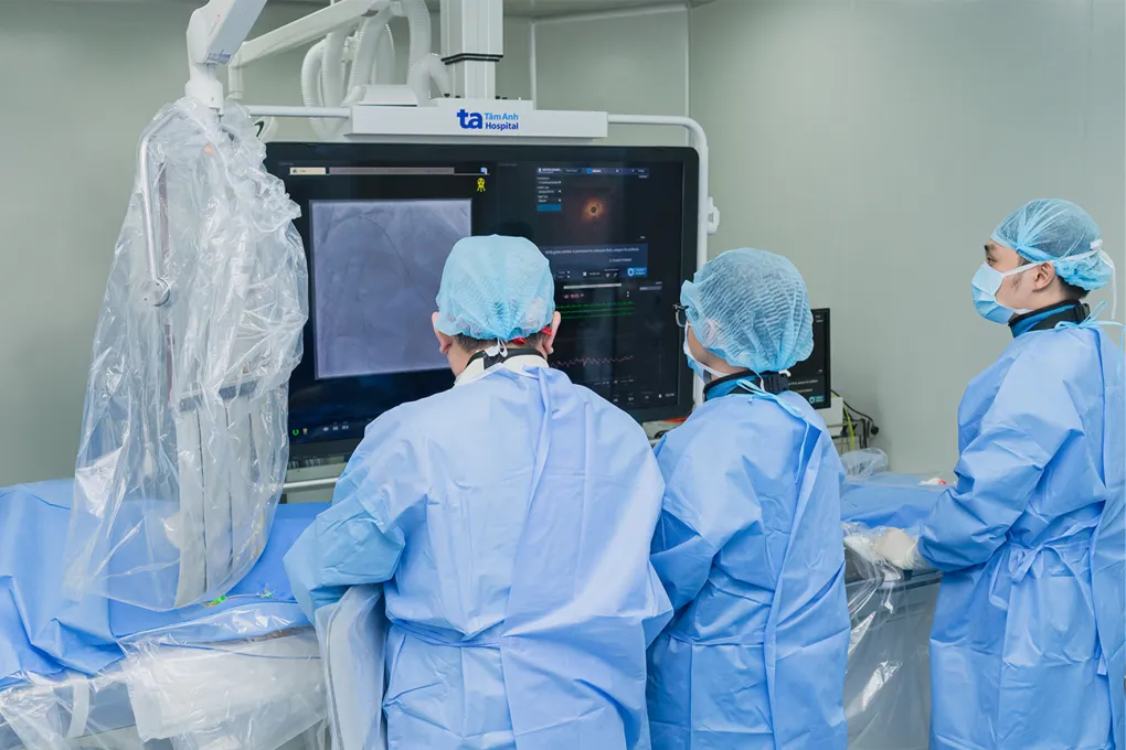 E-kip-can-thie-p-cho-da-o-die-1559-9952-1745418211