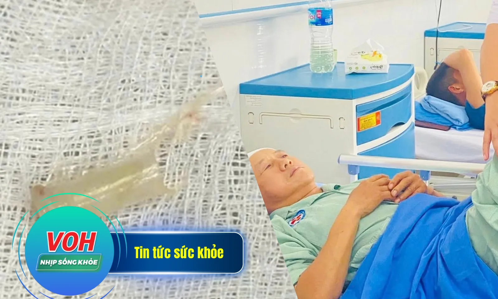 Nhịp sống khỏe 25/4: Bé trai 7 tuổi thở ra...tiếng kèn | Sọ não nặng do tấm gỗ đổ trúng đầu