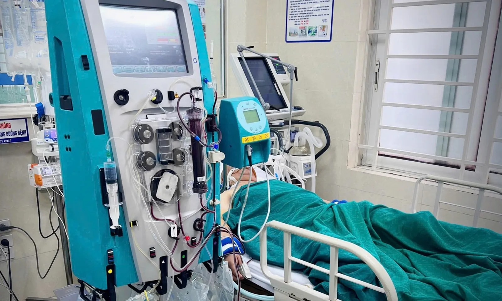 Suýt tử vong vì uống phải rượu giả chứa cồn công nghiệp