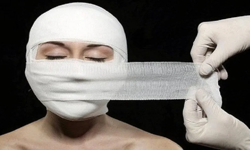 Mặt biến dạng sau khi sửa mũi nhiều lần tại cơ sở thẩm mỹ không phép