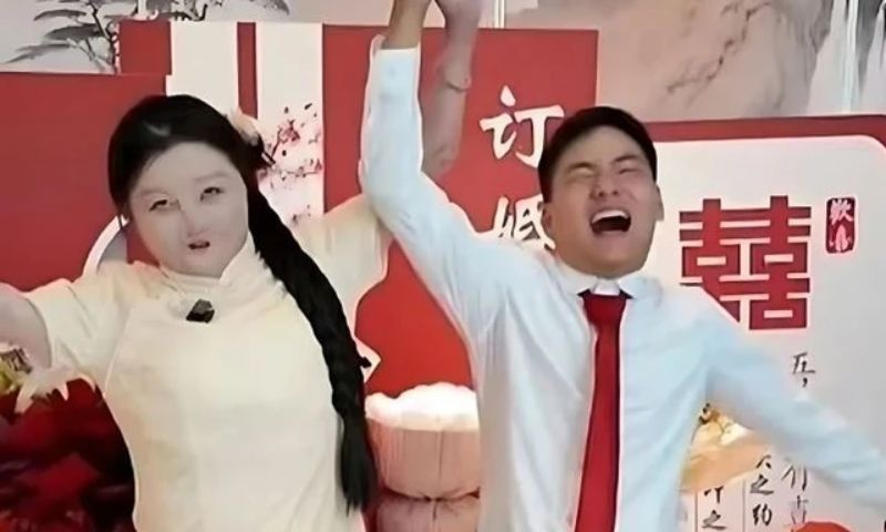 Cô gái bị bỏng 95% cơ thể đính hôn với bạn trai sinh cùng ngày, tháng, năm
