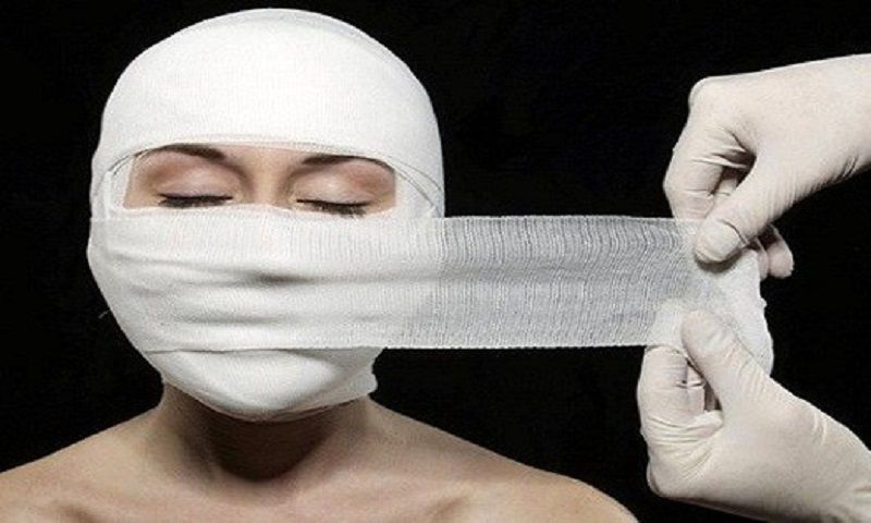 Cứu sống bệnh nhân sốc phản vệ nguy kịch sau phẫu thuật thẩm mỹ bằng kỹ thuật ECMO lai ghép