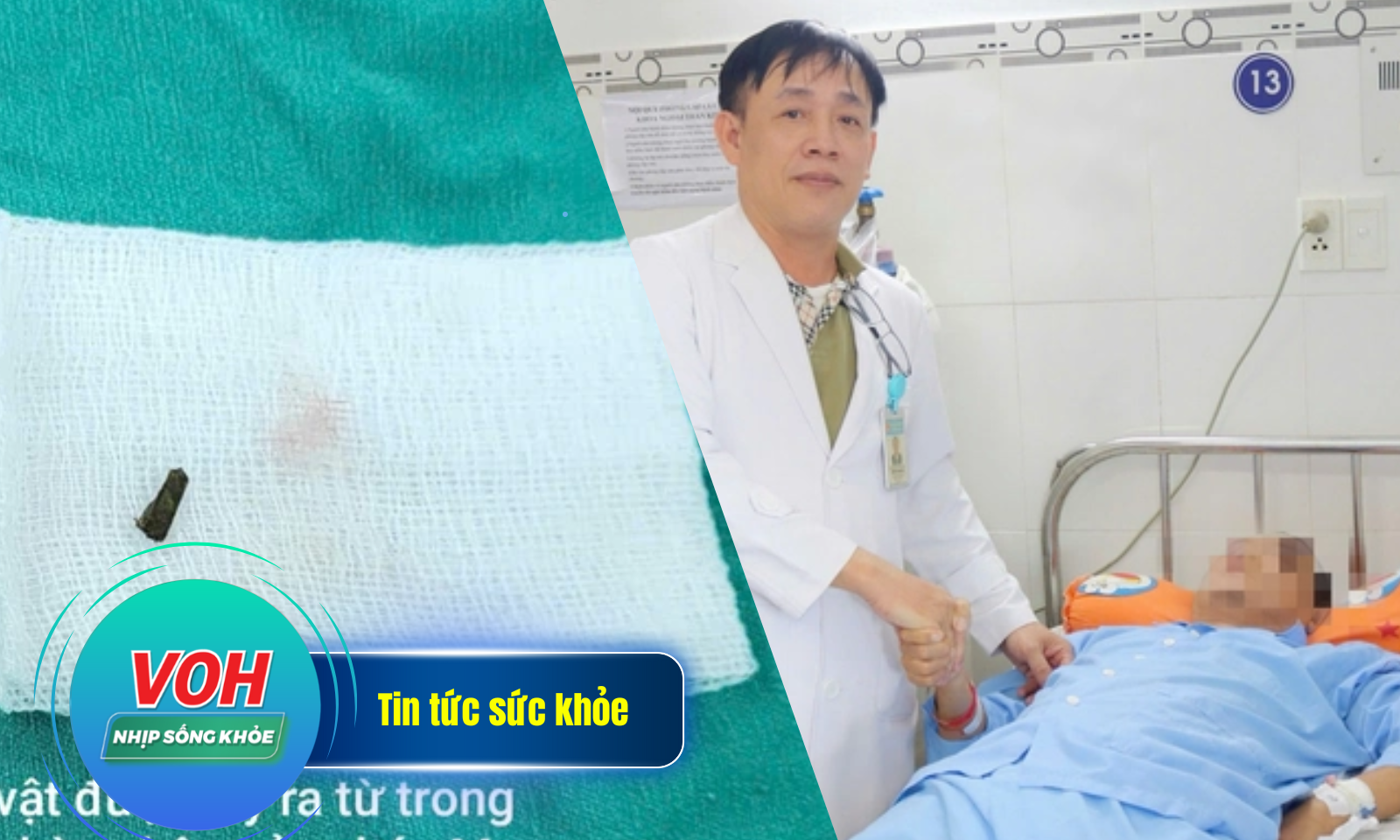 Nhịp sống khỏe 2/5: Mổ sọ cứu bệnh nhân xuất huyết não | Co giật vì mảnh gỗ đâm chân khi đá bóng