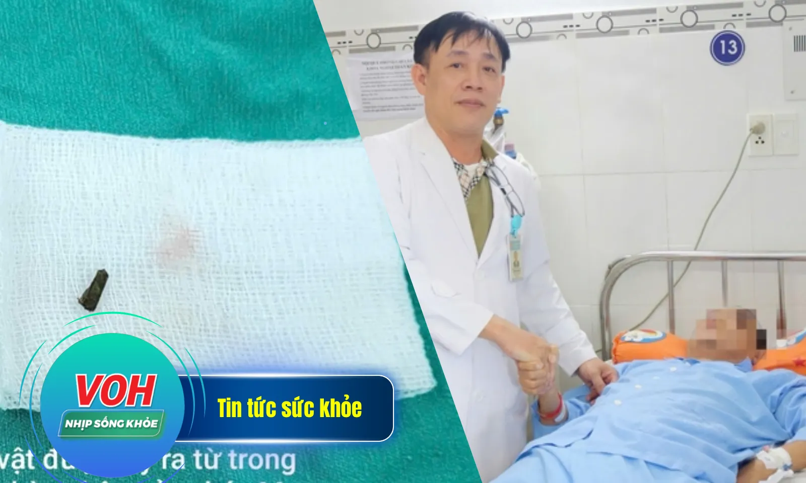 Nhịp sống khỏe 2/5: Mổ sọ cứu bệnh nhân xuất huyết não | Co giật vì mảnh gỗ đâm chân khi đá bóng