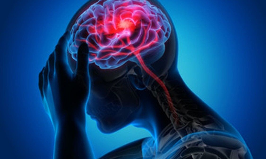 Vi nhựa trong máu có thể làm tăng nguy cơ đột quỵ