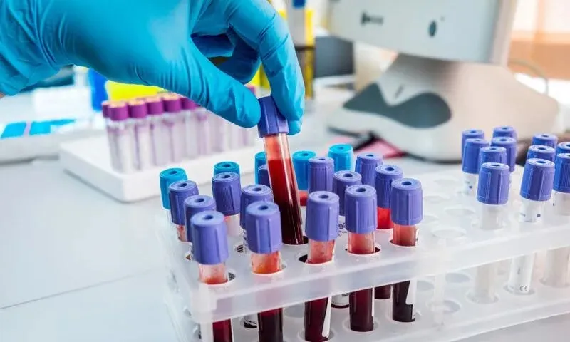 Hơn 40% người Việt có cholesterol máu cao