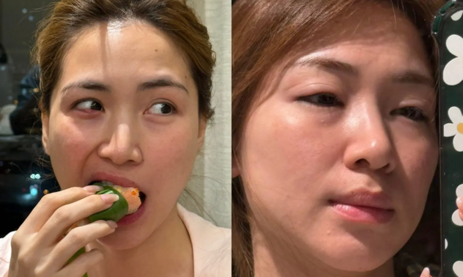 Bản sao của thumb liên cầu lợn