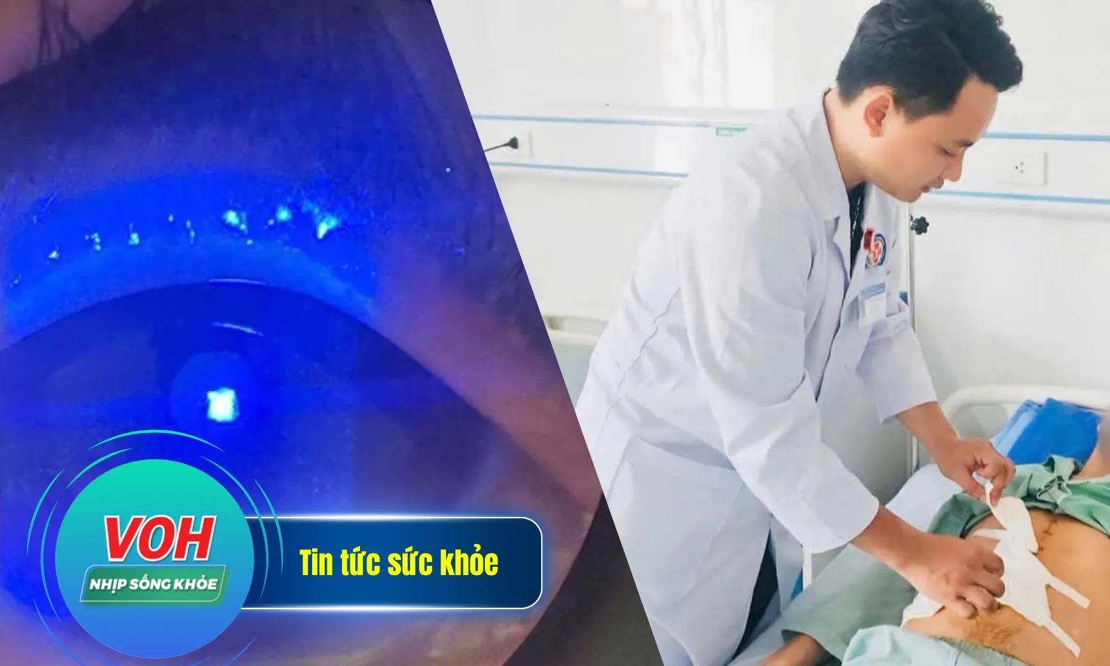 Nhịp sống khỏe 13/5: Tự đâm vào bụng do rối loạn lo âu | Suýt mù vì nhỏ nhầm dầu gió vào mắt