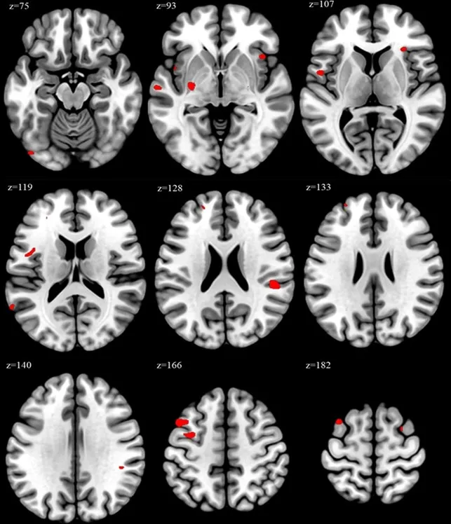 anh MRI