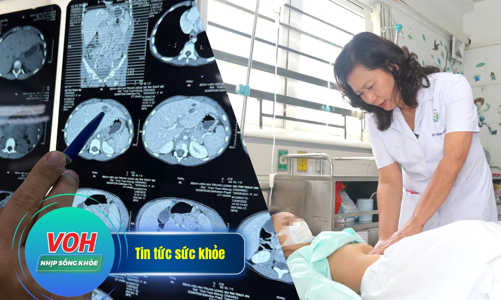 Nhịp sống khoẻ 19/5: Nhiễm 4 loại giun sán do ăn cua đá nướng | Bé gái sốc do phát hiện mang NST nam