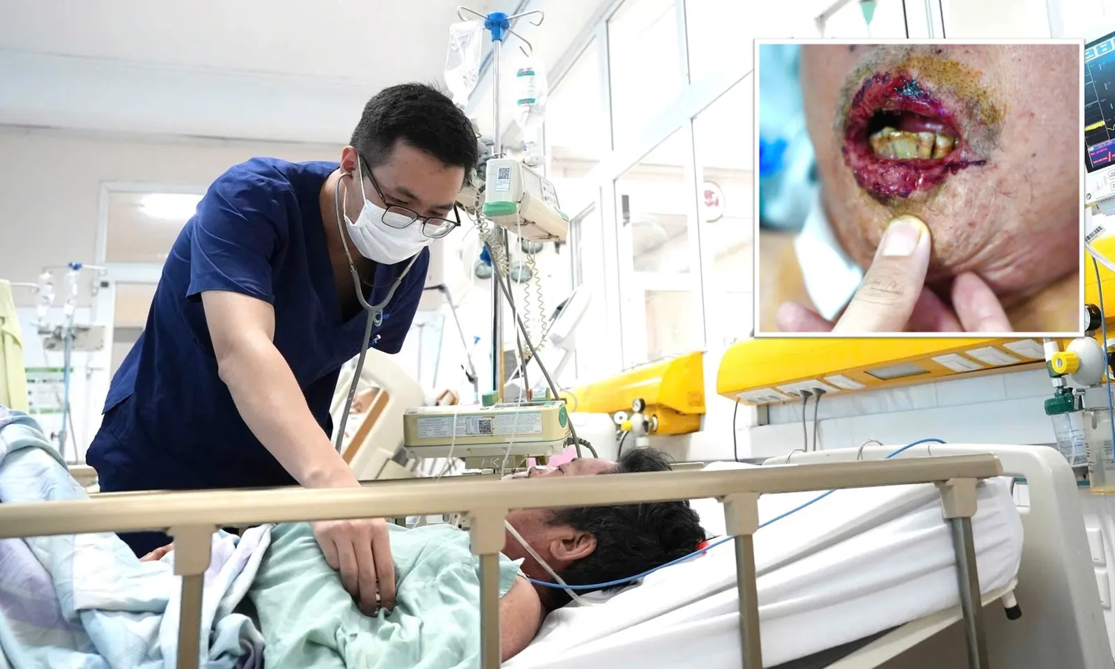 Tự mua thuốc nam dạng bột trên mạng để uống, người đàn ông nhiễm độc nặng, lở loét toàn thân