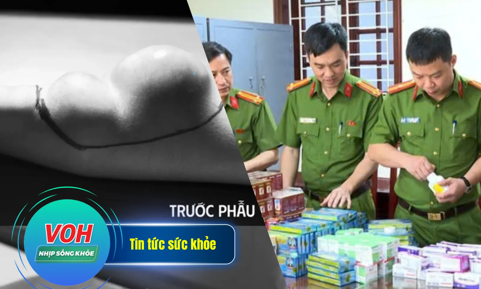 Nhịp sống khỏe 20/5: Đau tay suốt 9 năm do ung thư hiếm | TPHCM phát hiện 8 cơ sở bán thuốc giả