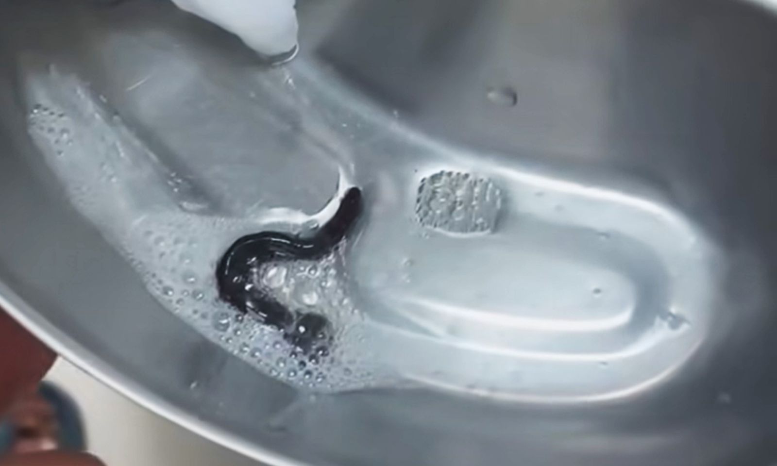 Phát hiện con đỉa trong đường thở bé trai sau một tuần bị ho ra máu