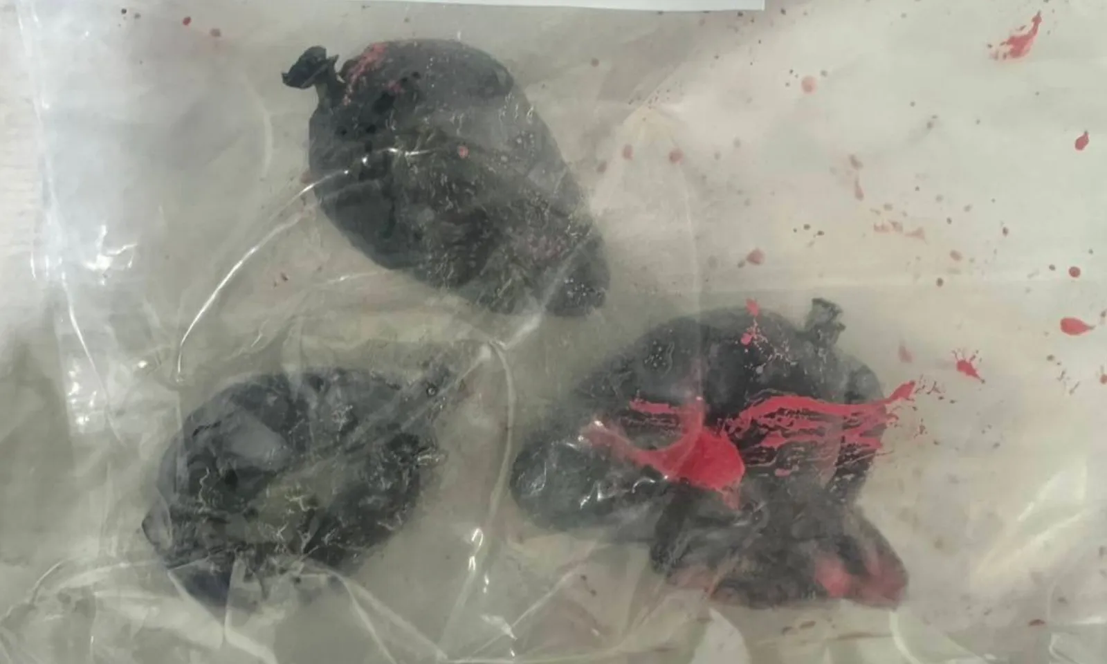 Gói ma túy ‘phát nổ’ trong ruột du khách người Áo tại sân bay Bangkok