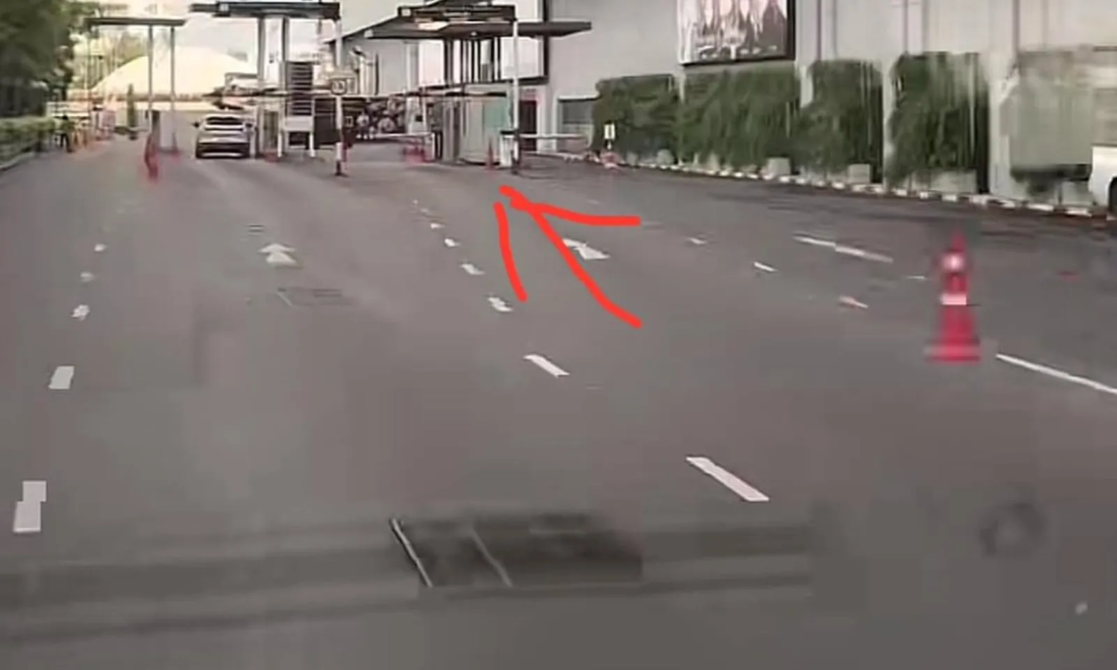 Bị máy bán vé đỗ xe tự động ‘giật điện’, người phụ nữ tê liệt cánh tay